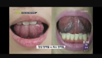 Are the veins under your tongue black?