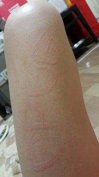 병x주의)피부에 opgg를 새겨보았다