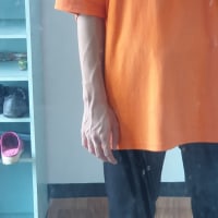 옵붕이 이승을 뜰지도 몰라...