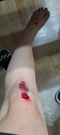 퀵보드가 이렇게 위험합니다