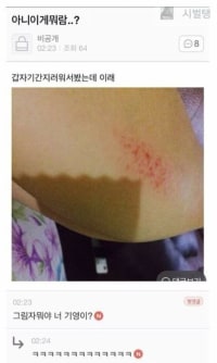 실제로 존재하는 기영이 머리