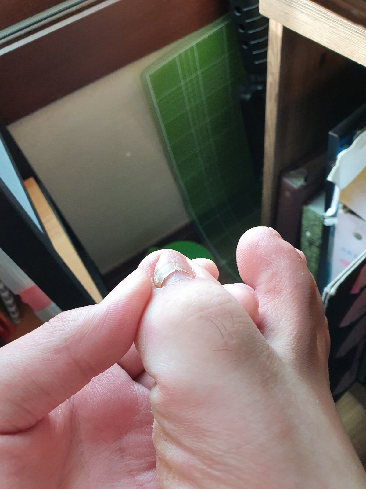 오른엄지발톱