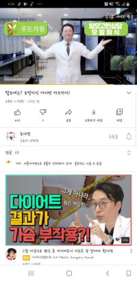 ㅋㅋ탈모 영상 보는데 탈모 광고 나오네 ㅋㅋ