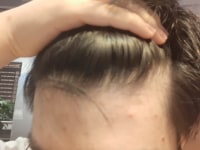 Is this balding?