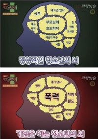 게임하는 청소년의 뇌.jpg