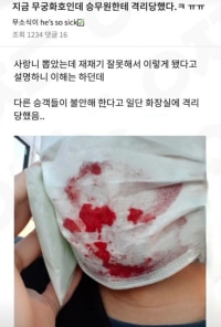 사랑니 뽑고 기차 타면 안됨