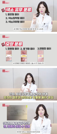 피부과 눈나가 말해주는 흉터 치료