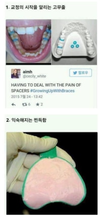 치아교정시 겪는것