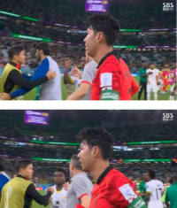 엄청 부어있던 손흥민 얼굴상태