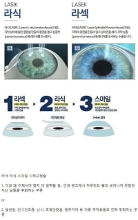 하고 나서 대부분 후회하는 수술