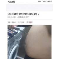 (펌)하... 나도 자살한다 말리지마라.