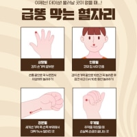 급똥 막는 혈자리