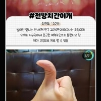 희귀하다는 신체 특징