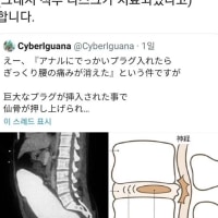 척추가 조때버린 롤붕이들을 위한 치료법