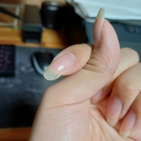 손톱 용접할수있는 약같은거 없음?