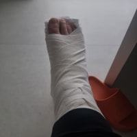 어제 계단에서 구른 옵붕이인데