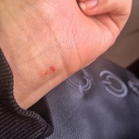 하 씨 손목에 상처남