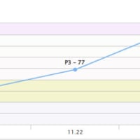 소신발언) 매칭주작은 전혀 없다